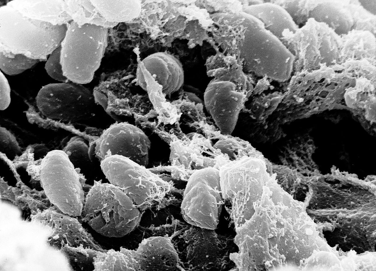 Bactérie de la peste
