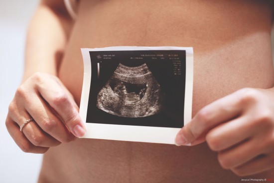 échographie foetale imagerie